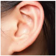 Family traits - Fused ear lobe